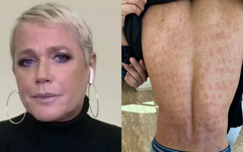 Empresa de Xuxa se manifesta em meio a escândalo com pacientes queimados